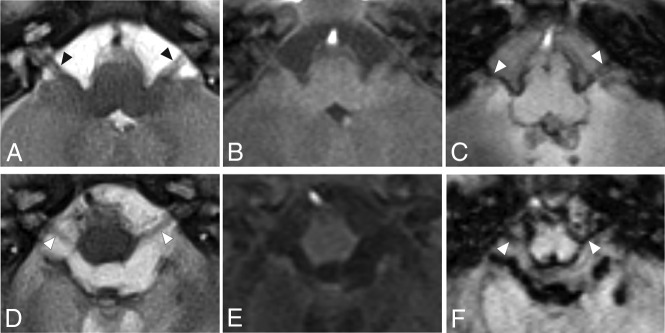 FIG 4.