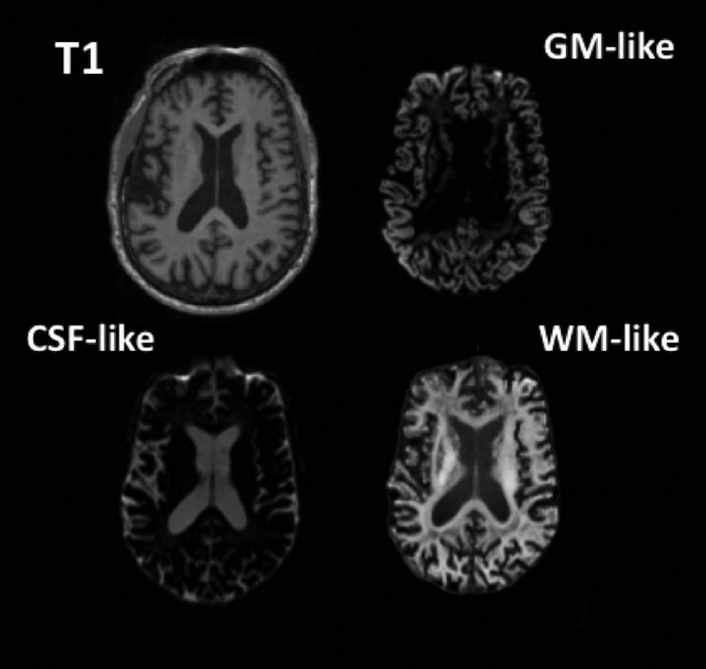 Figure 1: