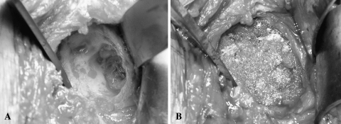 Fig. 1A–B