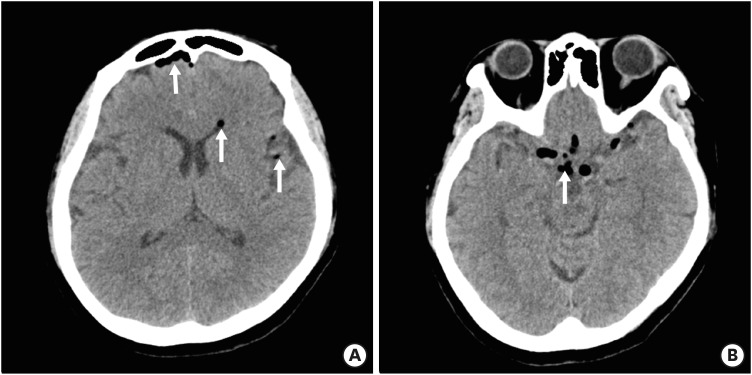 FIGURE 1