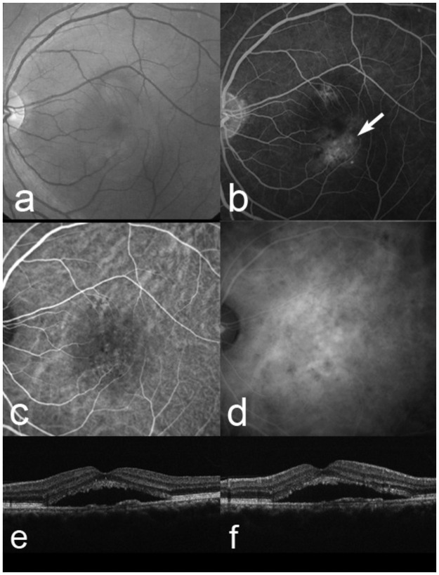 Fig 6