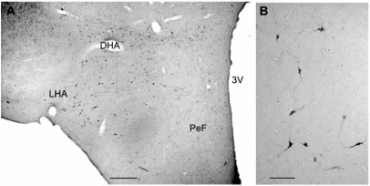 Fig. (2)