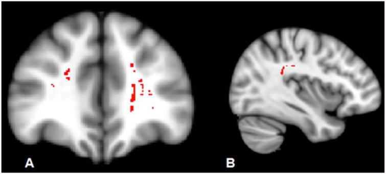 Fig. 2: