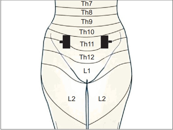 Fig. 2.