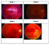 Fig. (2)