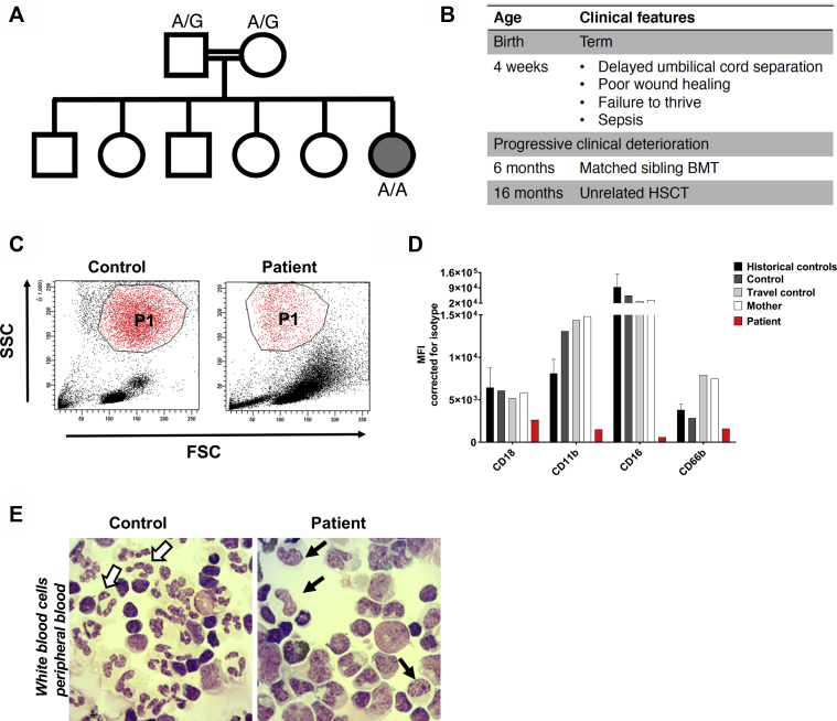 Fig 1