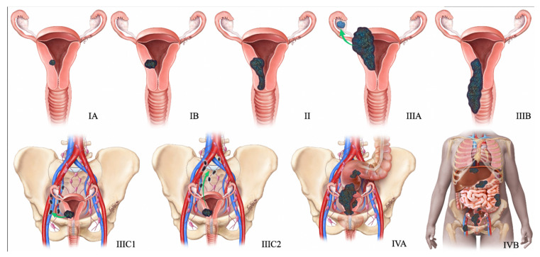 Figure 12