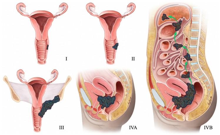 Figure 14