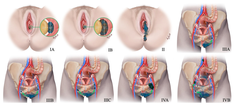 Figure 16