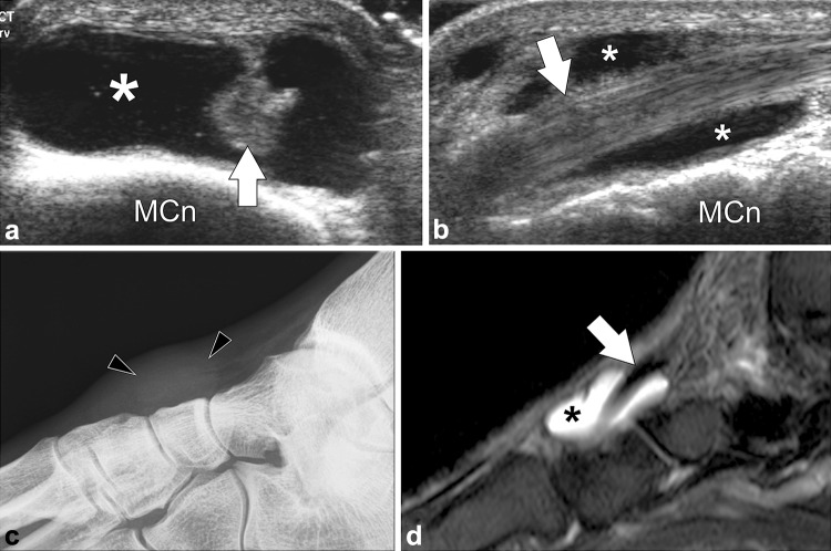 Fig. 10