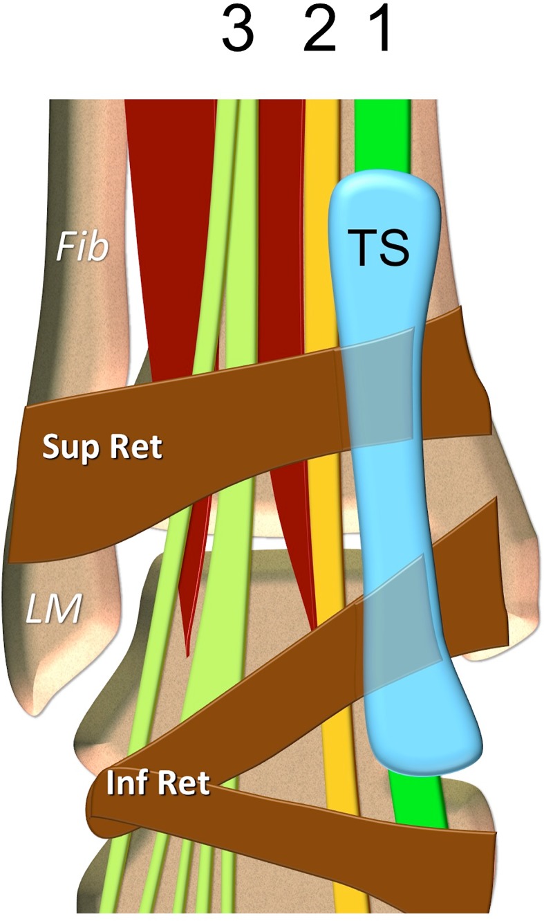 Fig. 2