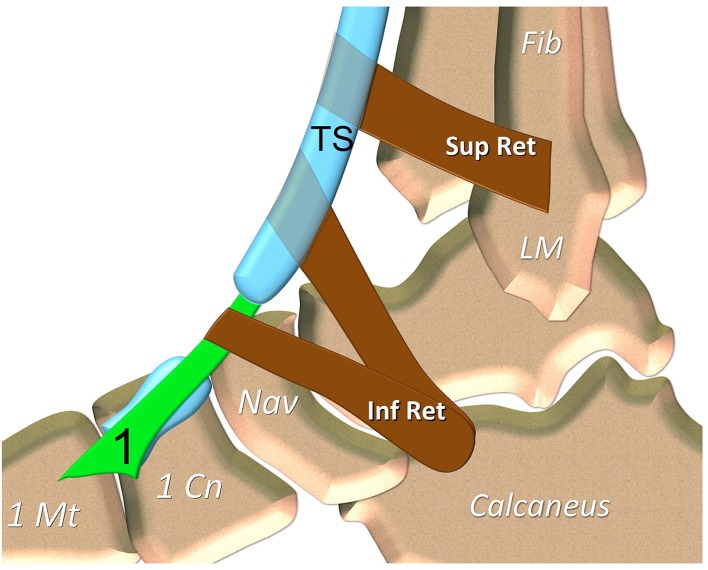 Fig. 3