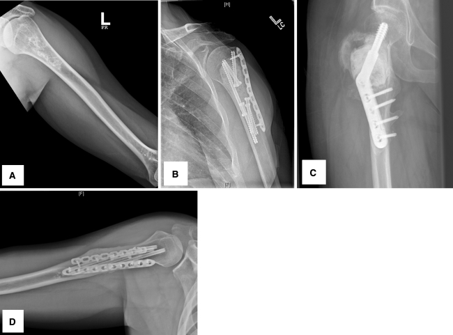 Fig. 2A–D