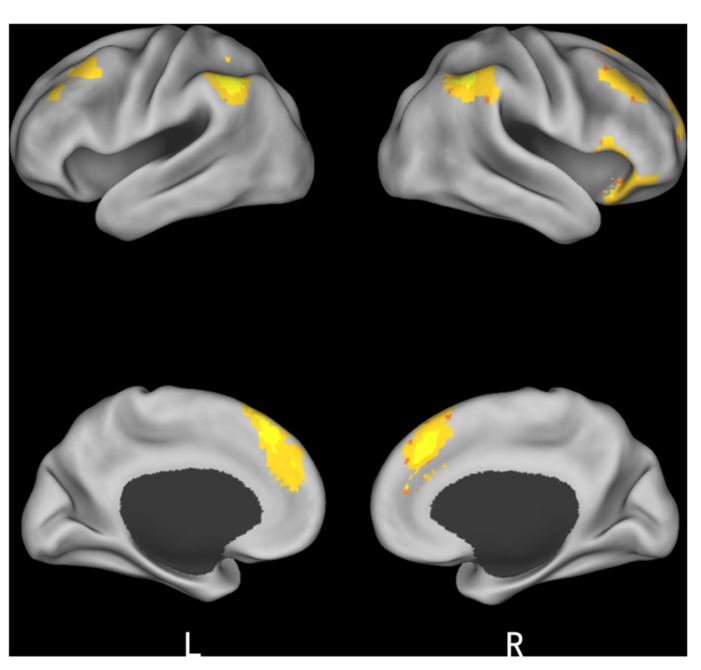 FIGURE 4