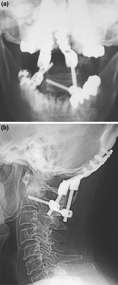 Fig. 2