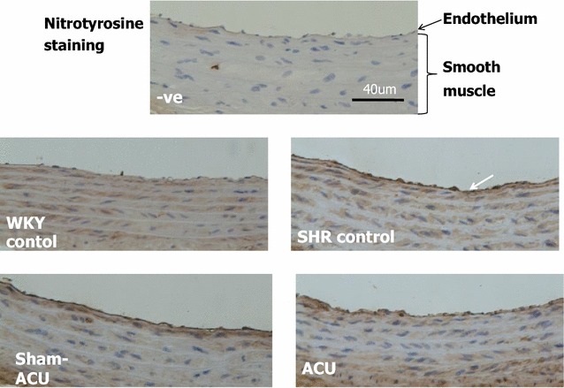 Fig. 11