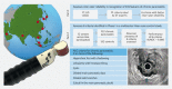 graphic file with name 10-1055-a-1217-3112-i18857en0.gif