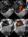 Fig. 4