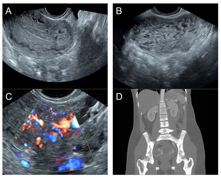 Figure 6