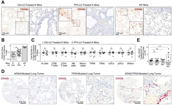 PF4 promotes platelet production and lung cancer growth - PMC