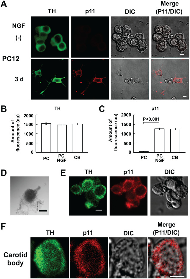 Expression of p11 and Heteromeric TASK Channels in Rat Carotid Body ...