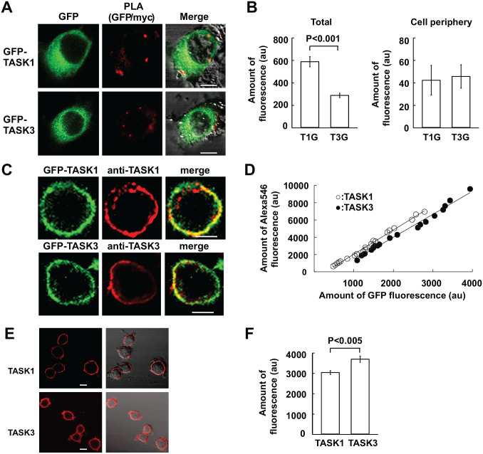 Expression of p11 and Heteromeric TASK Channels in Rat Carotid Body ...