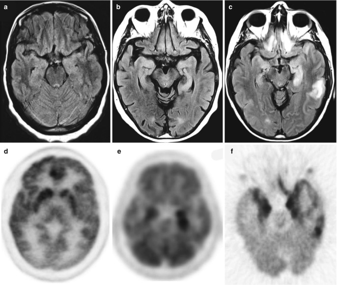 Fig. 17.1