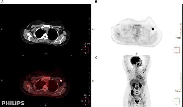 Figure 2