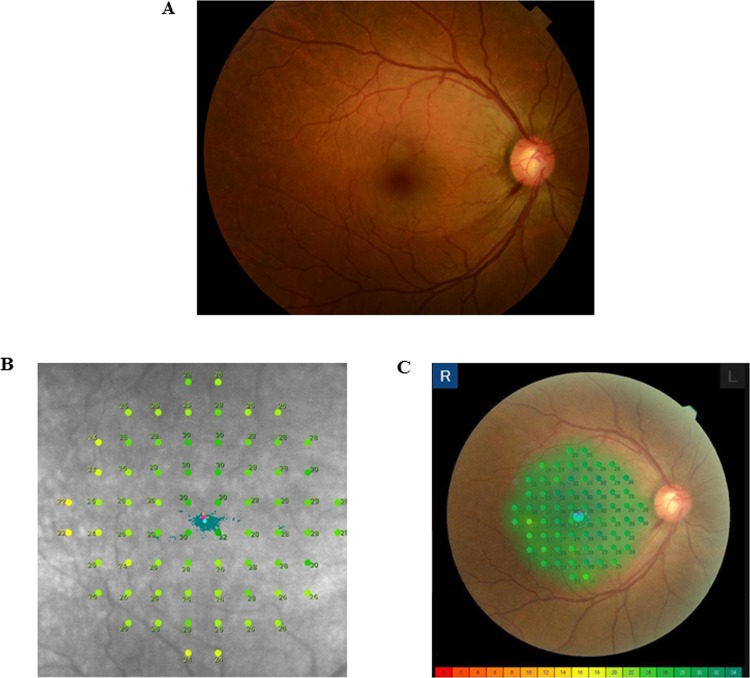 Fig 1