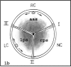 Figure 1b