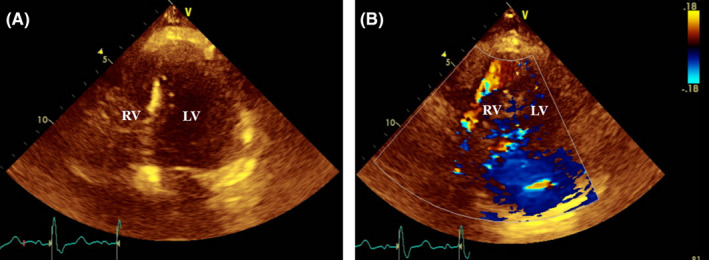 FIGURE 4