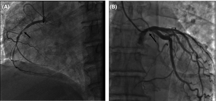 FIGURE 3