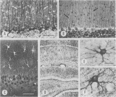 graphic file with name pnas00462-0514-b.jpg