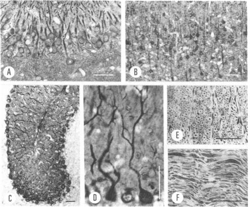 graphic file with name pnas00462-0513-a.jpg