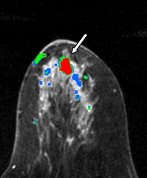 Figure 3b: