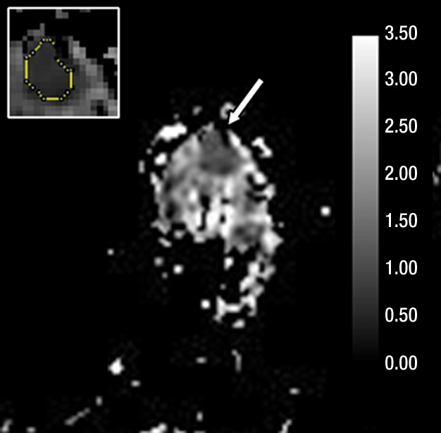 Figure 3e: