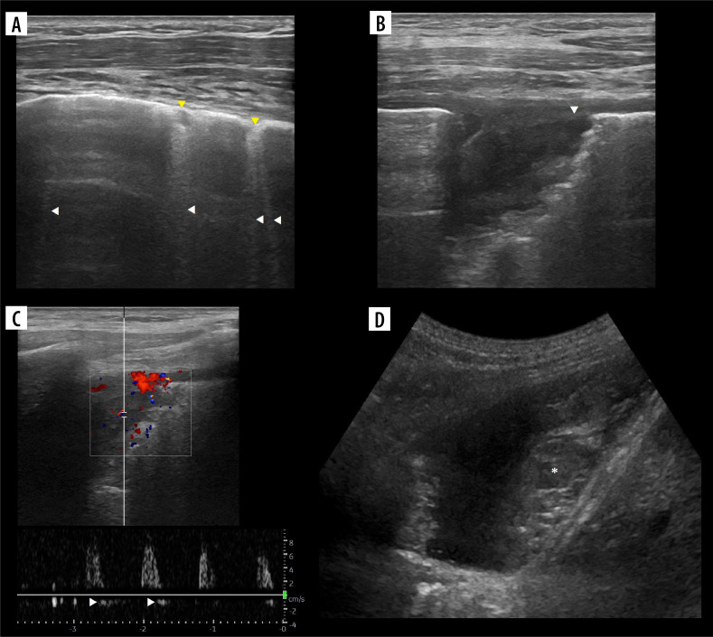 Figure 14