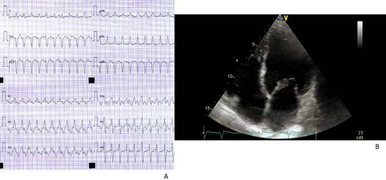 Fig. 3