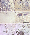 Fig. 11.
