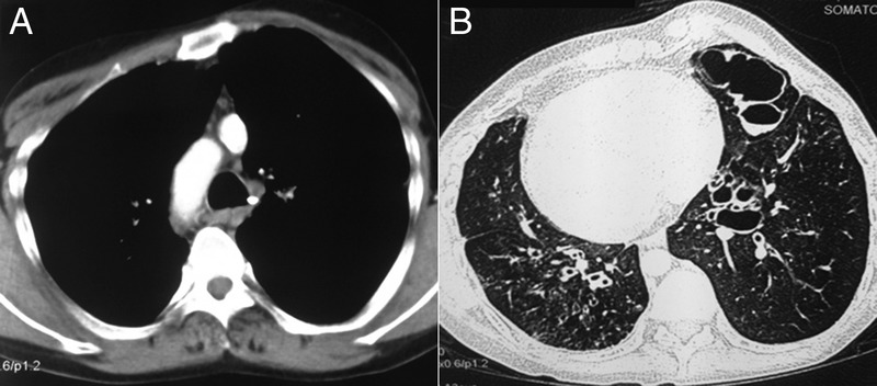 Figure 2