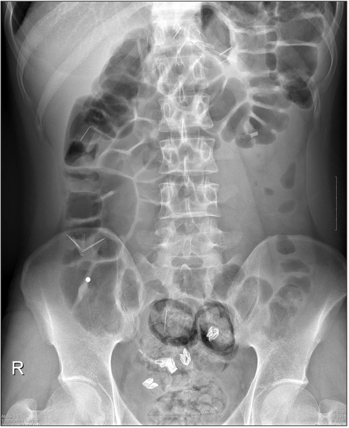 Fig. 1