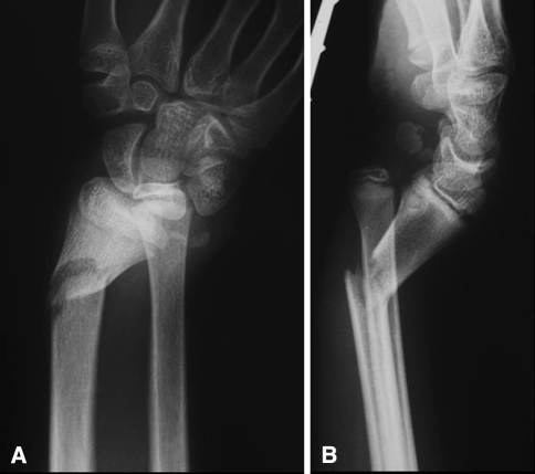 Fig. 1A–B