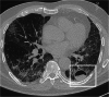 Fig. 12