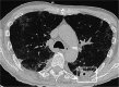 Fig. 11