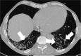 Fig. 13