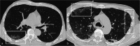 Fig. 9
