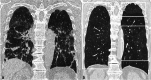Fig. 14