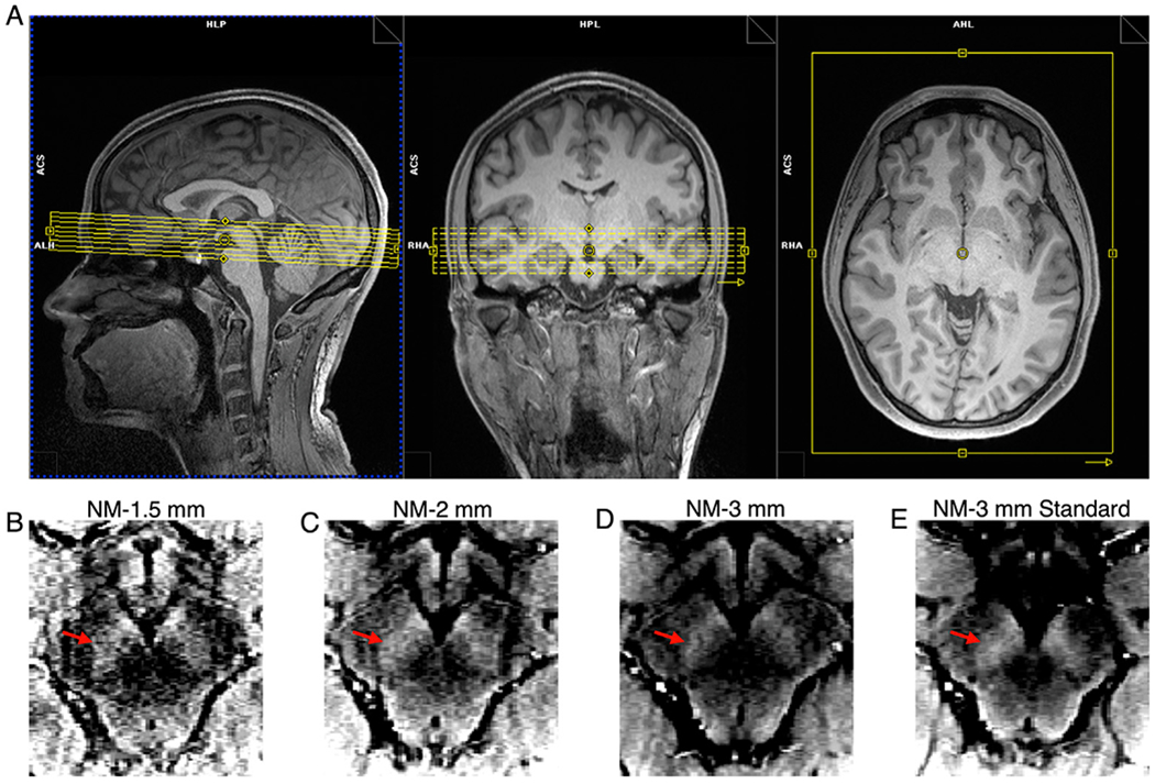 Fig. 2.