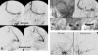 Fig 2.