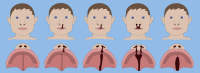 Fig. 1